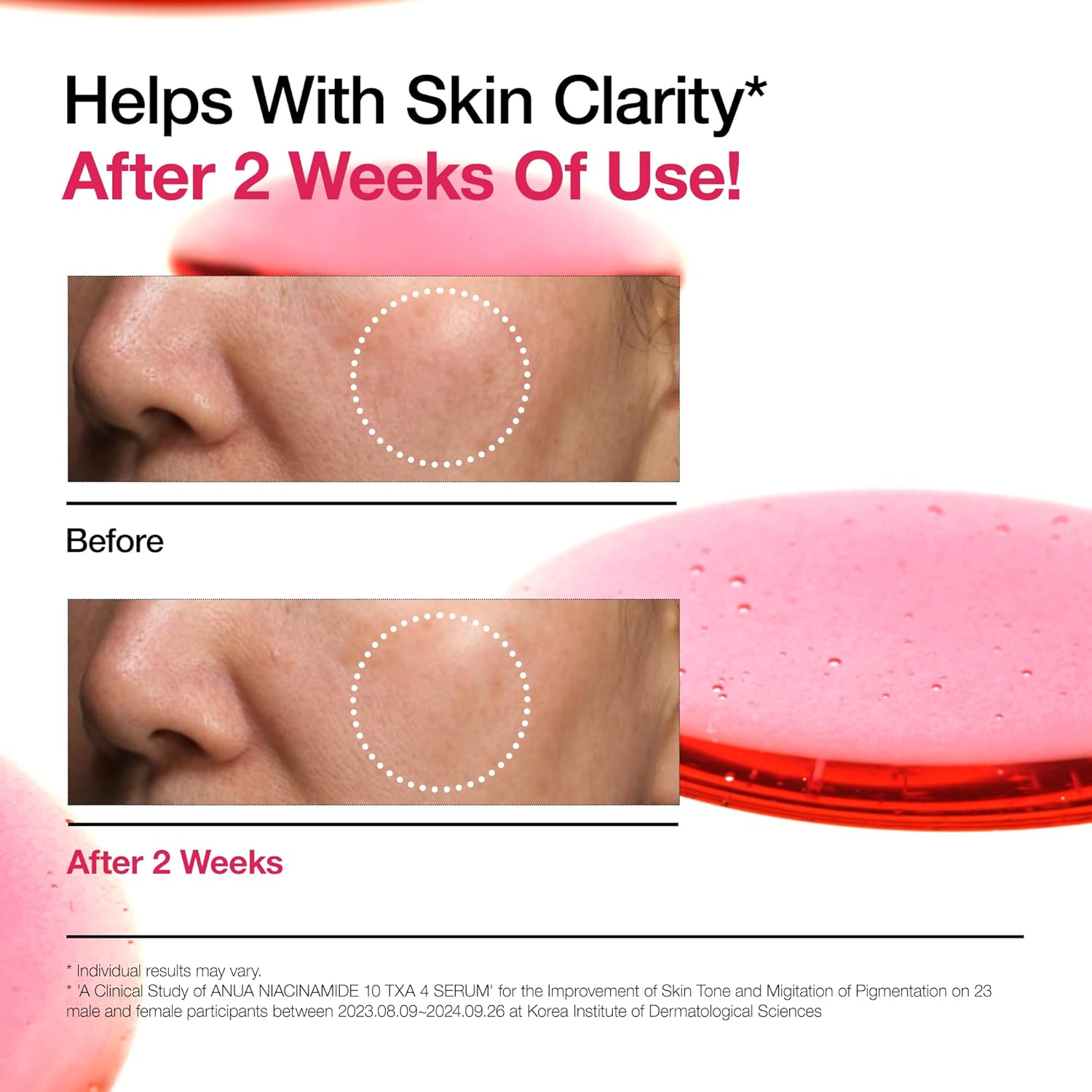 Anua Niacinamide 10 + TXA 4 Serum, Hyaluronic Acid, Tranexamic Acid, Vitamin B12, Facial Serum for Glass Skin, Clarifying, Colorful complexion, Korean Skin Care